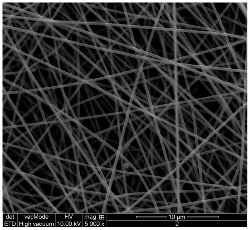 Antibacterial and anti-adhesion nanofiber dressing free of bandage fixation and preparation method of antibacterial and anti-adhesion nanofiber dressing