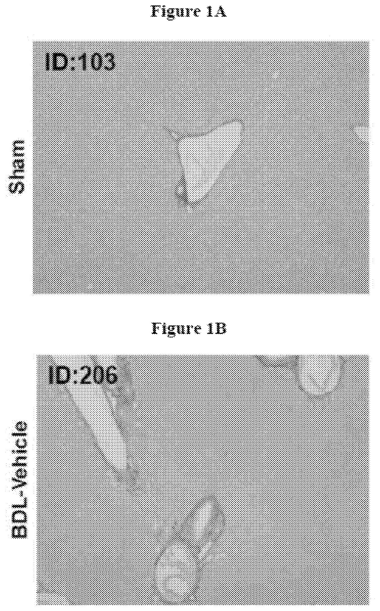 Pharmaceutical compositions for combination therapy