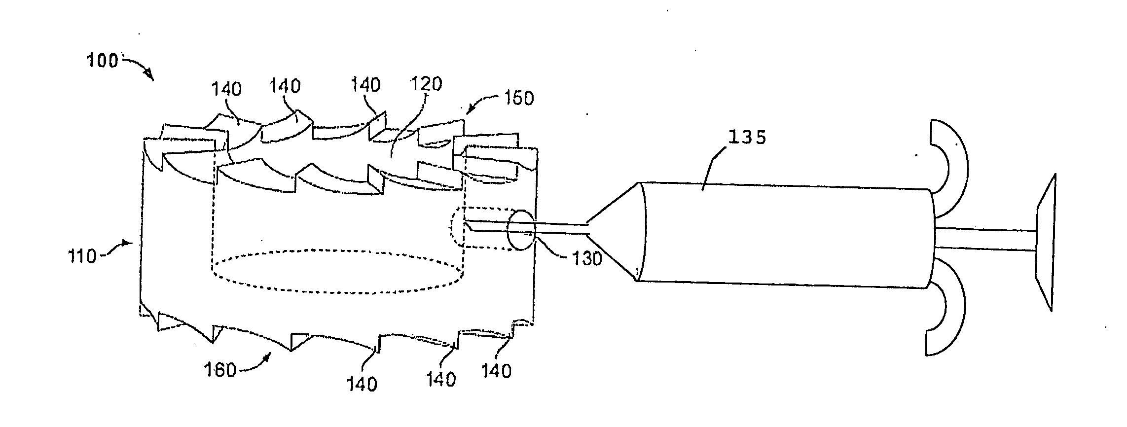 Fusion device, systems and methods thereof