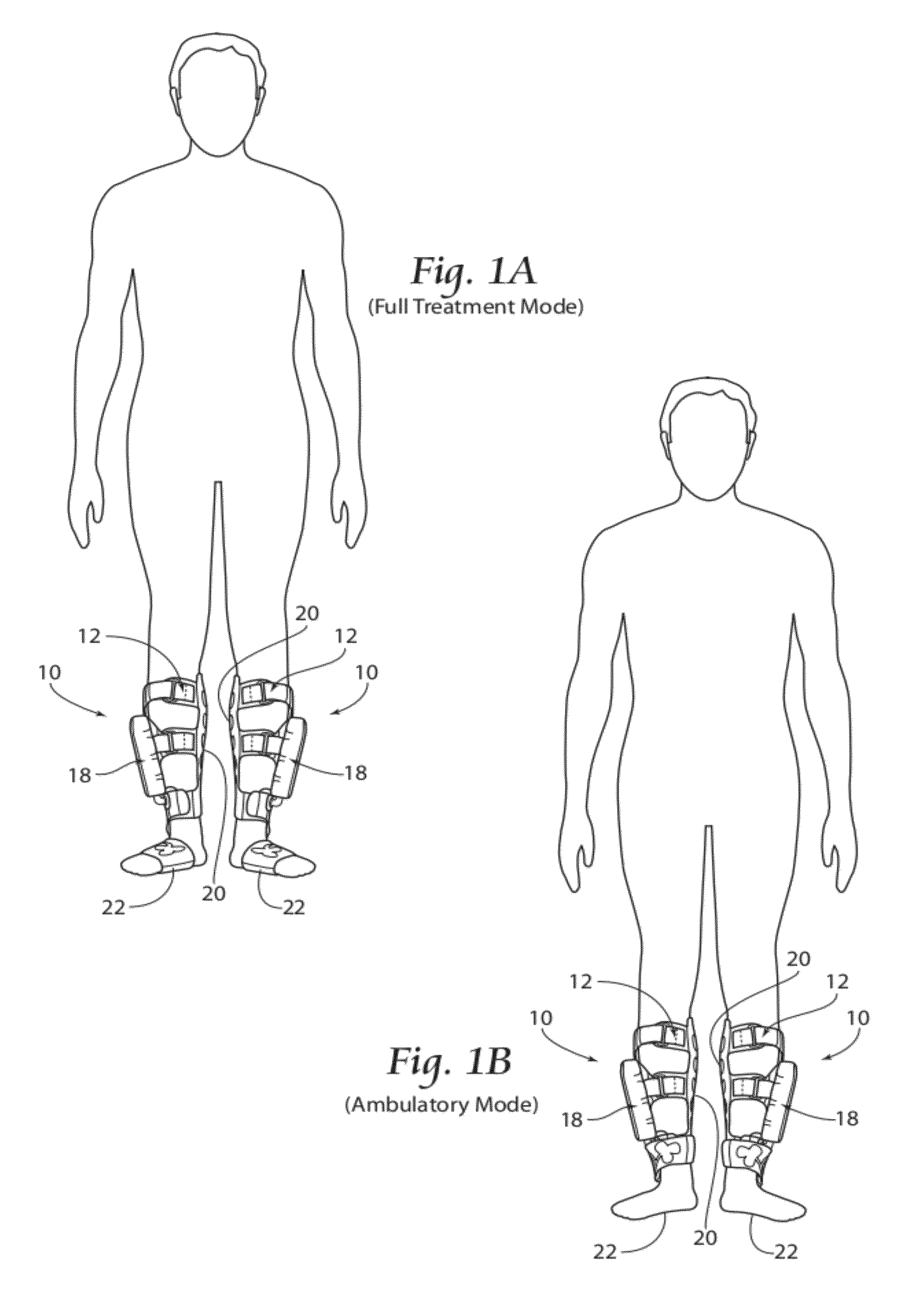 Apparatus, systems, and methods for augmenting the flow of fluid within body vessels