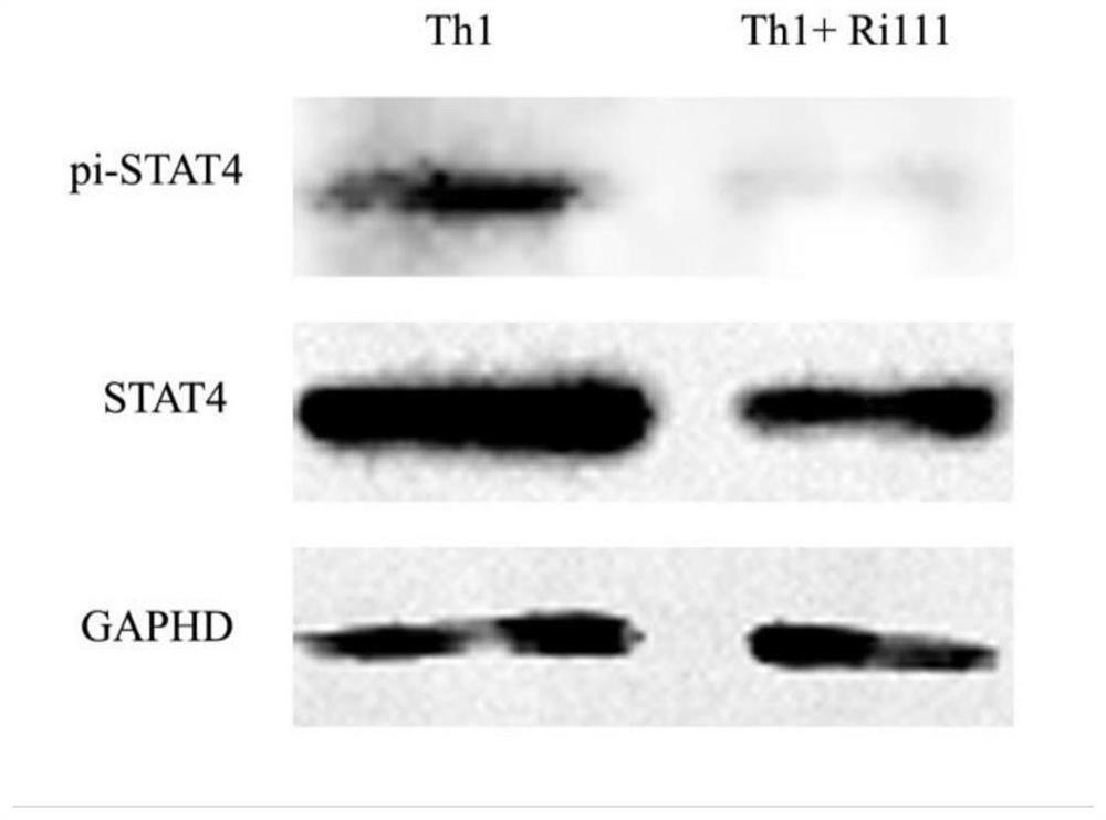 Application of Artificially Constructed Antisense Nucleotide Fragment ri111 in Th1 Cell Polarization