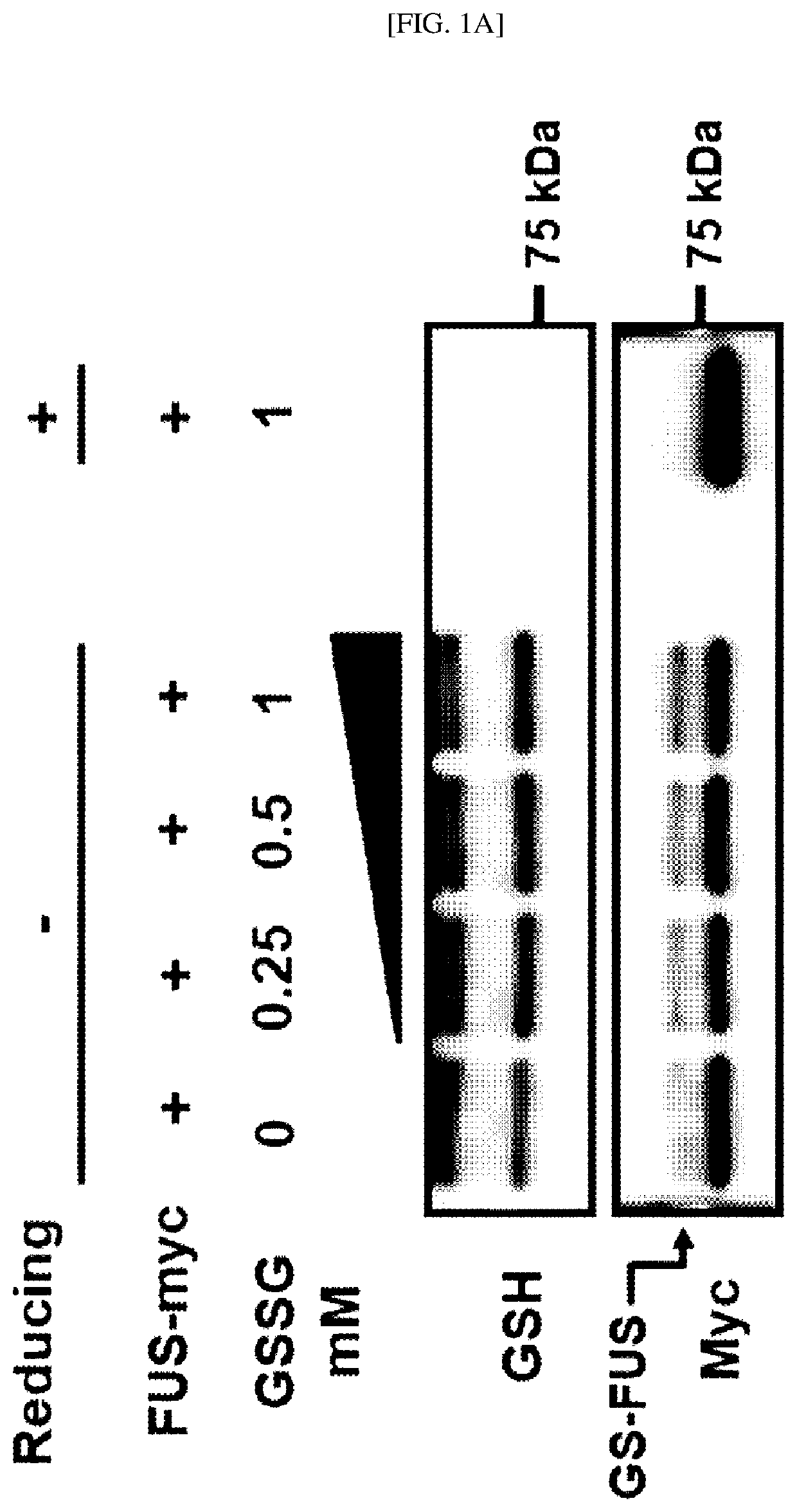 Marker for diagnosing neurodegenerative disease, and therapeutic composition