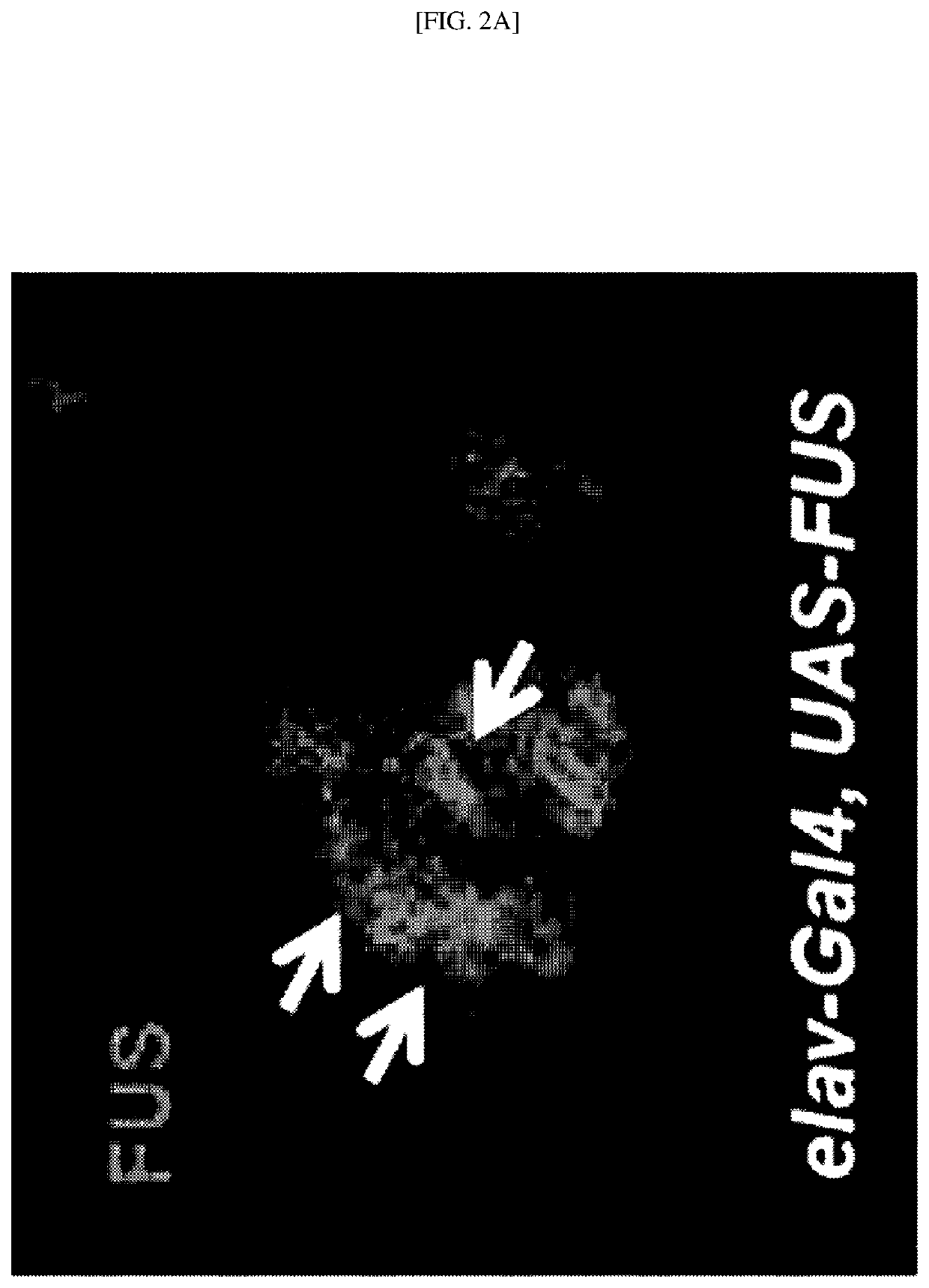 Marker for diagnosing neurodegenerative disease, and therapeutic composition