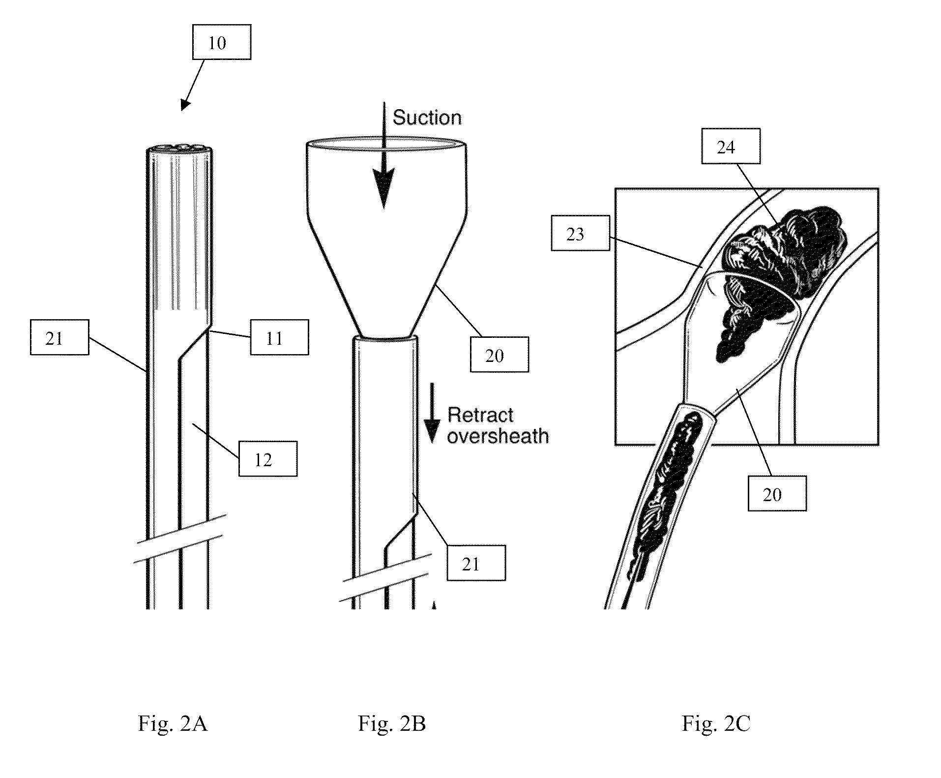 Systems and methods for removing undesirable material within a circulatory system during a surgical procedure