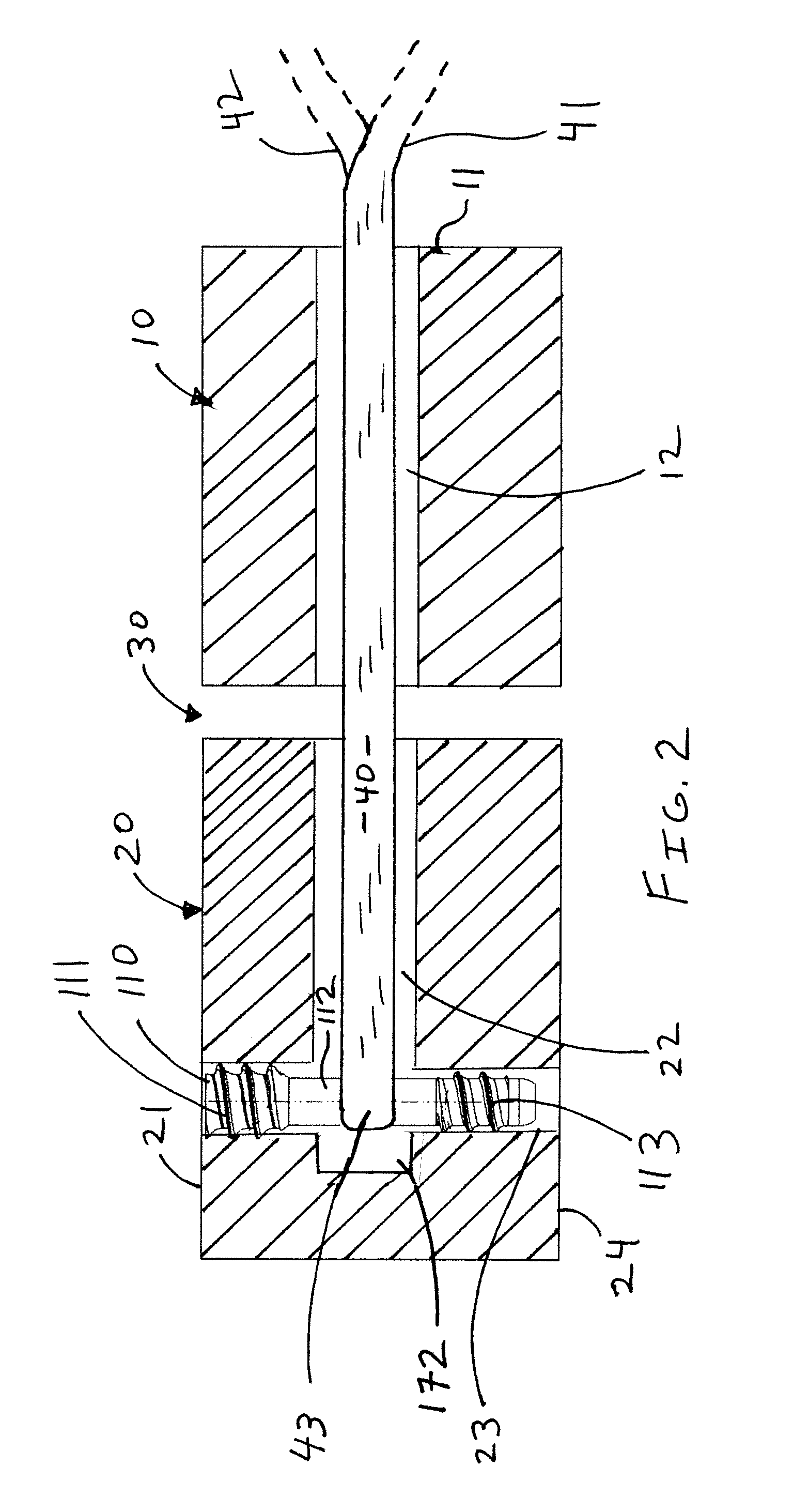 Method and apparatus for articular scapholunate reconstruction