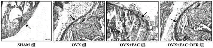 Use of deferasirox in preparation of medicine for treating postmenopausal osteoporosis diseases