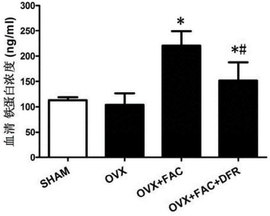 Use of deferasirox in preparation of medicine for treating postmenopausal osteoporosis diseases