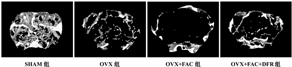 Use of deferasirox in preparation of medicine for treating postmenopausal osteoporosis diseases