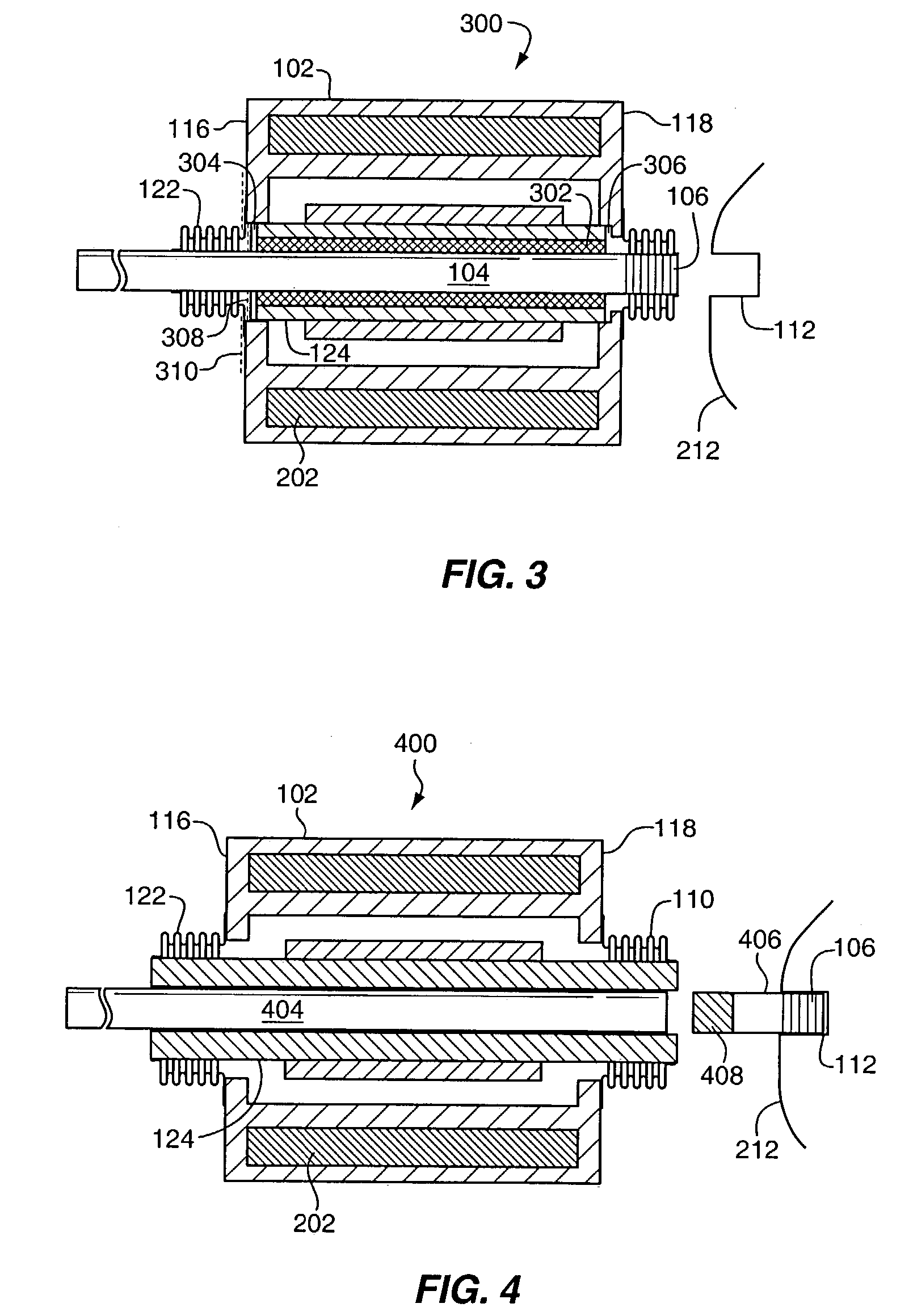 Implantable hearing aid transducer with advanceable actuator to facilitate coupling with the auditory system