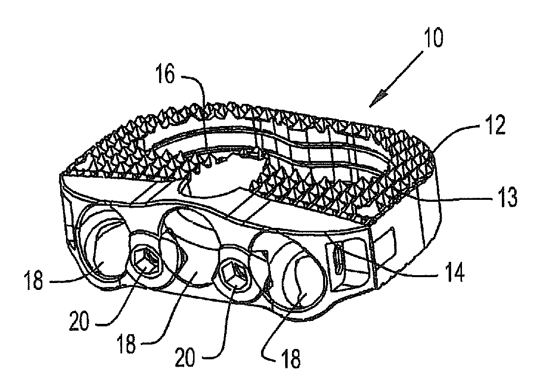 Intervertebral fusion implant