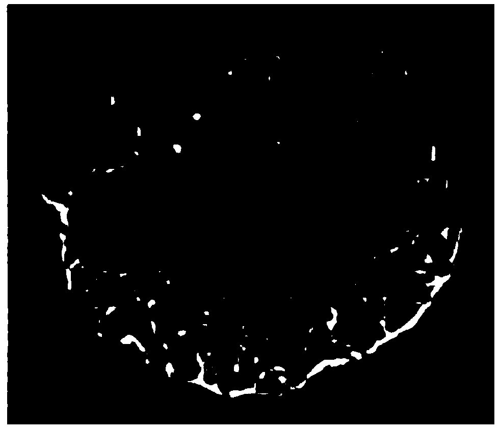 Drug-loaded microspheres loaded with oncolytic virus and preparation method thereof