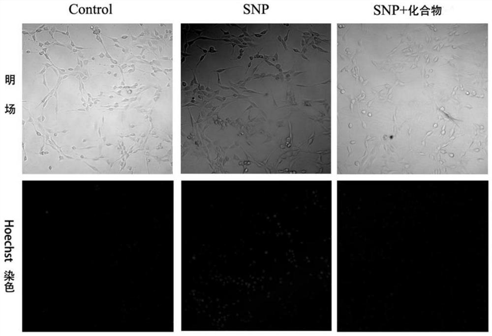 Tri-substituted phenyl-1, 2, 4-triazole derivative as well as preparation and application thereof in treatment of neuron injury