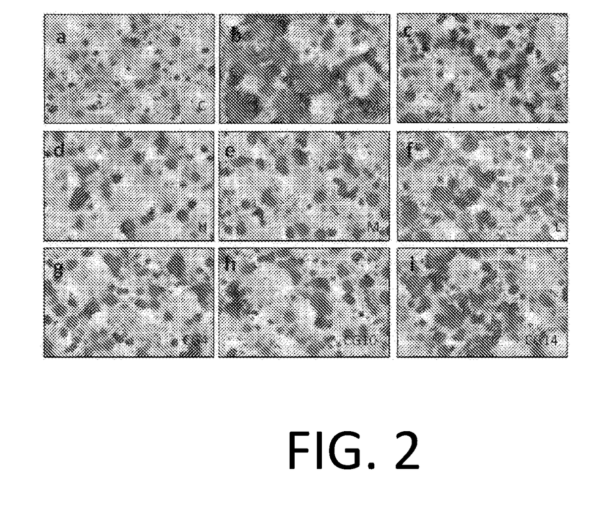 Compatible Composition Containing Chinese Medicine Cichorium Glandulosum Boiss Et Hout As Lipid-Lowering Active Ingredient