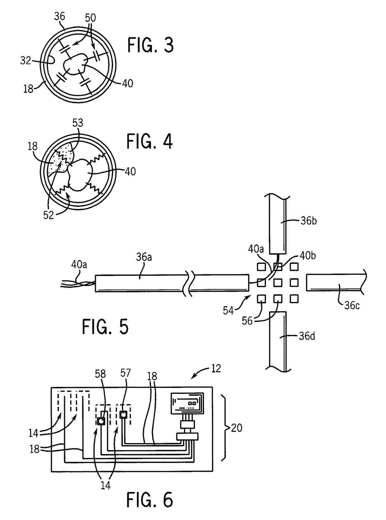 Tubular scaffold for neural growth