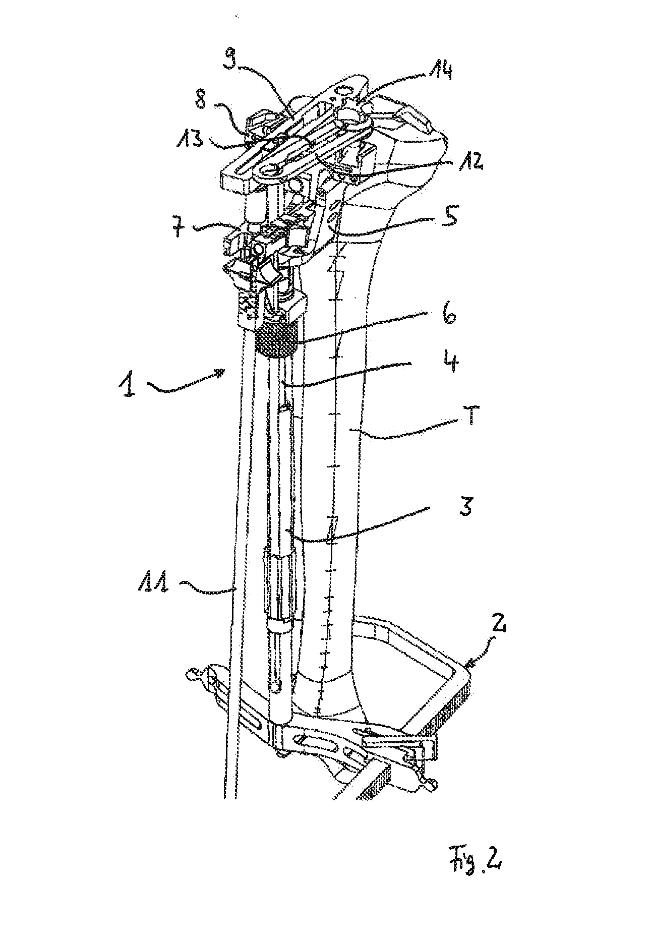 Device for defining a cutting plane for a bone resection
