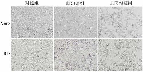 Coxsackie virus CVA16 virulent strain CVA16-B6-714 and application thereof