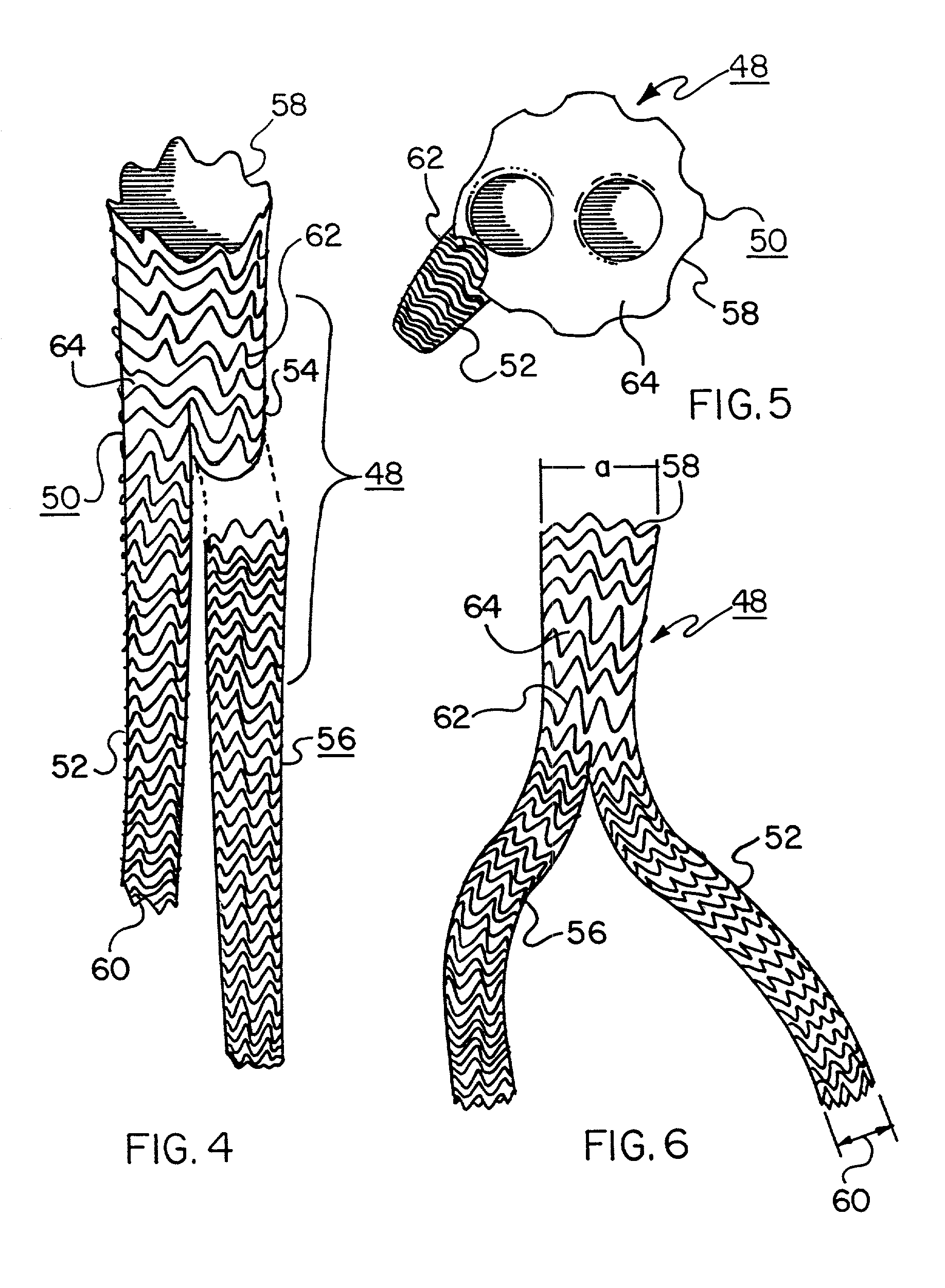 Method of producing low profile stent and graft combination