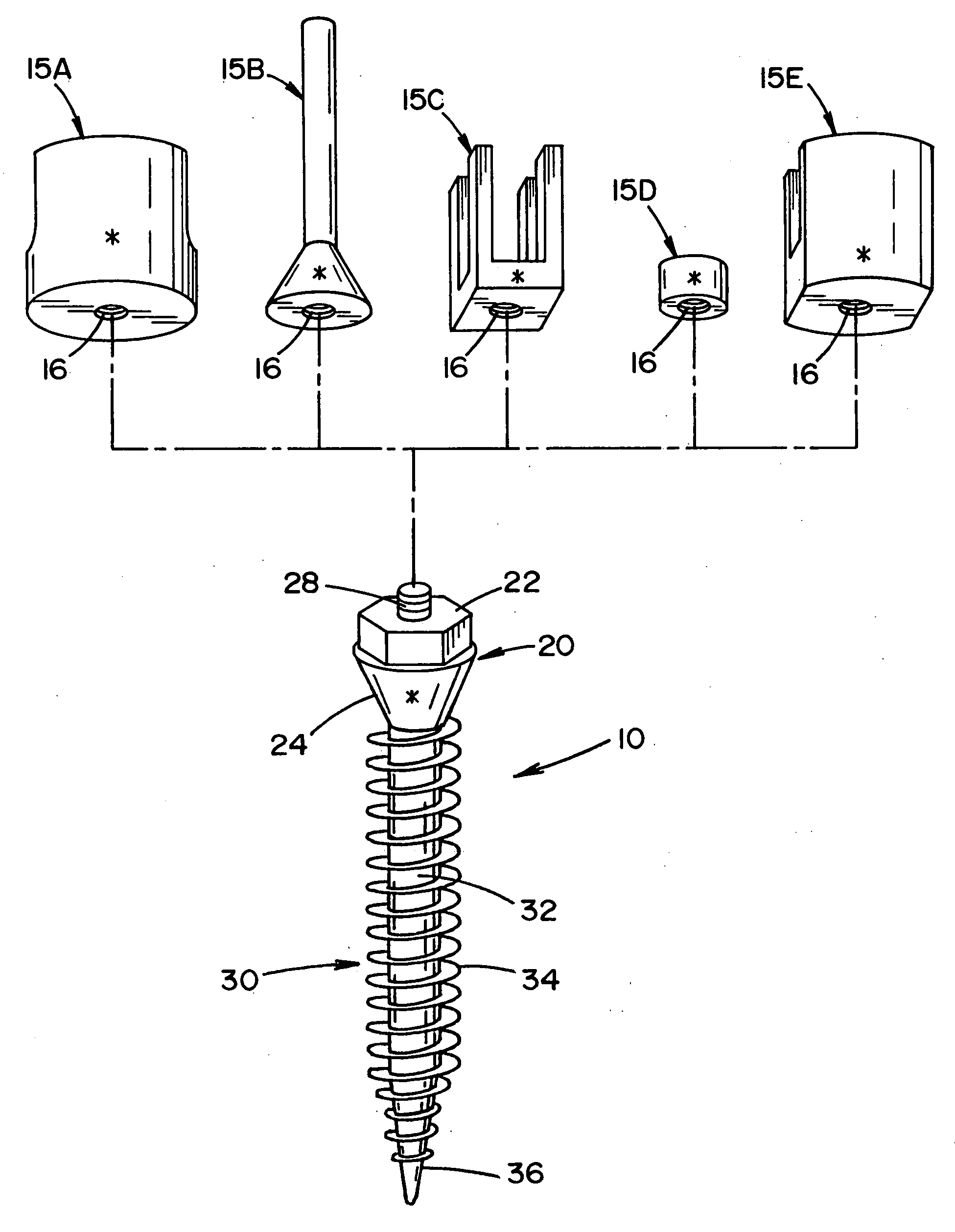 Bone anchor prosthesis and system