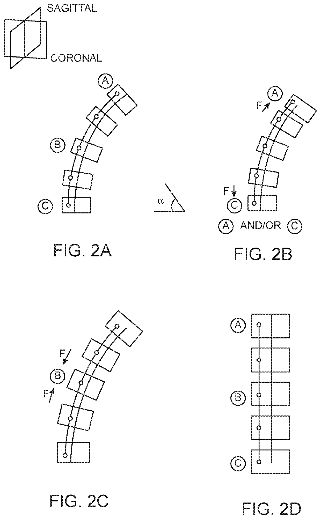 Spinal curvature modulation systems and methods