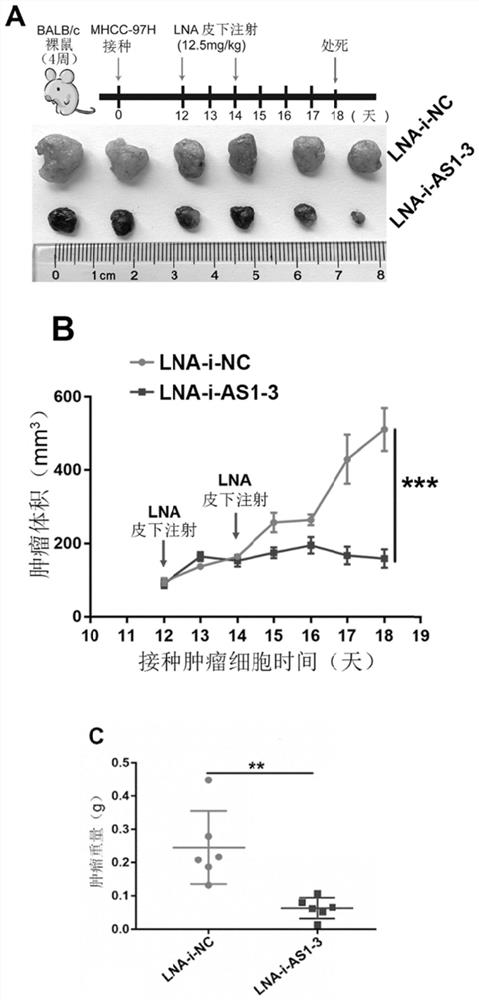 Application of UPK1A-AS1 inhibitor in preparation of antitumor drugs