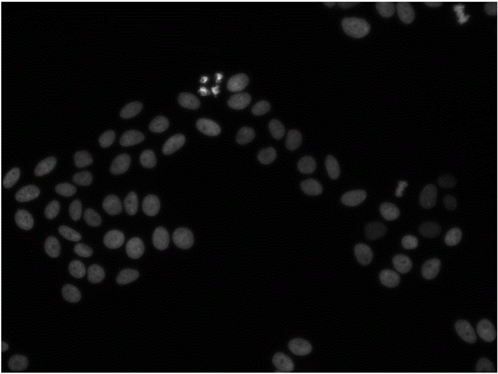 Particle swarm and fuzzy means clustering based cell image segmentation method