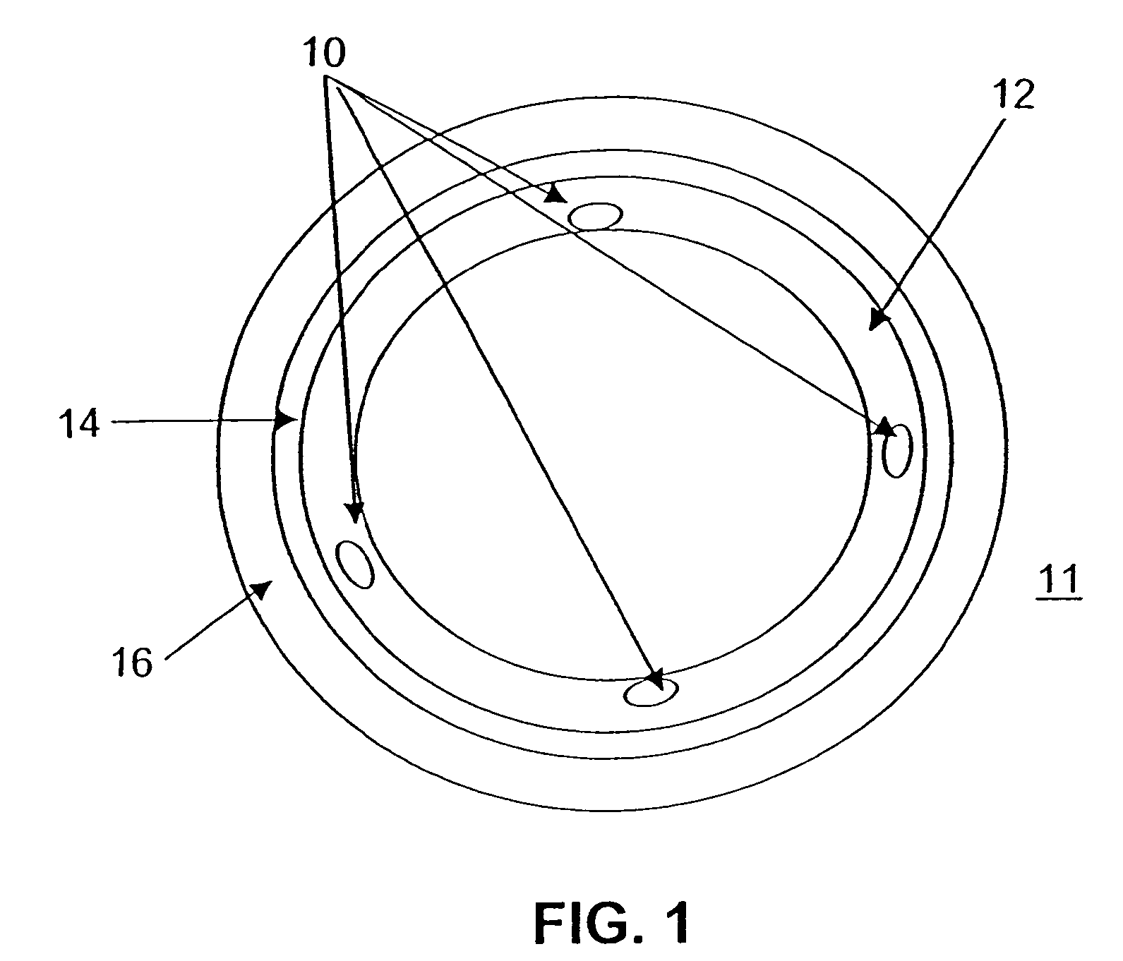 Bioactive stents for type II diabetics and methods for use thereof