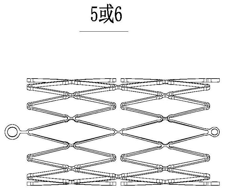 Self-expanding stent system