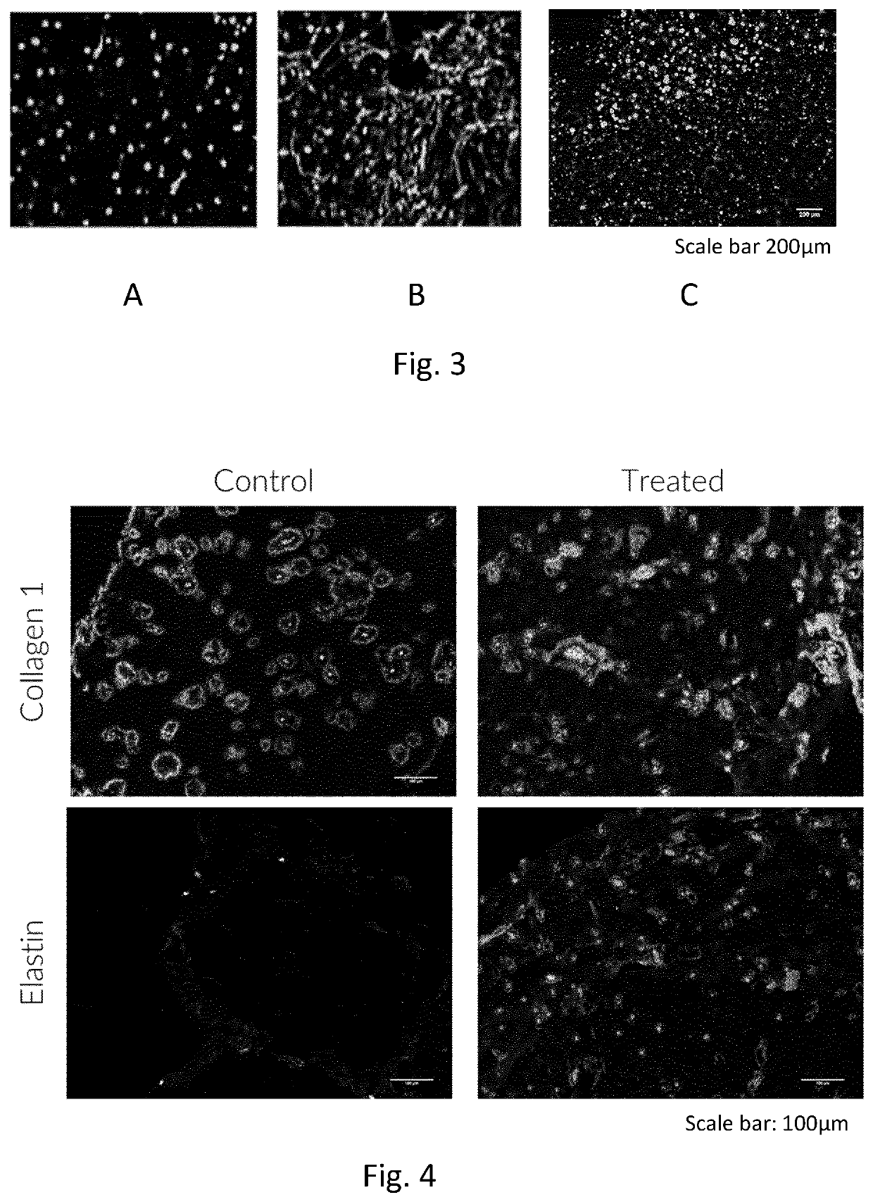 3D Bioprinted Skin Tissue Model