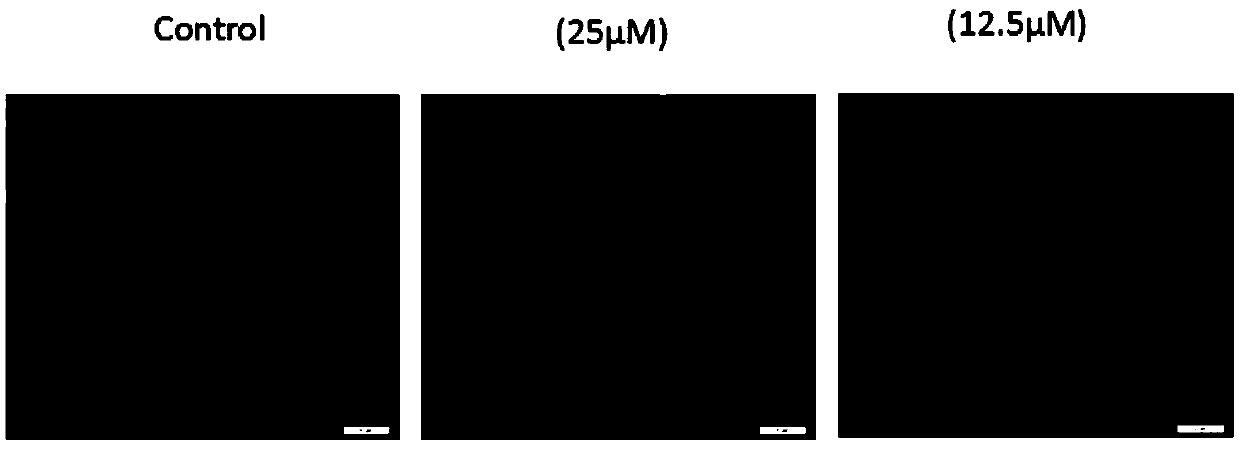 Cathepsin inhibitor as well as preparation method and application thereof