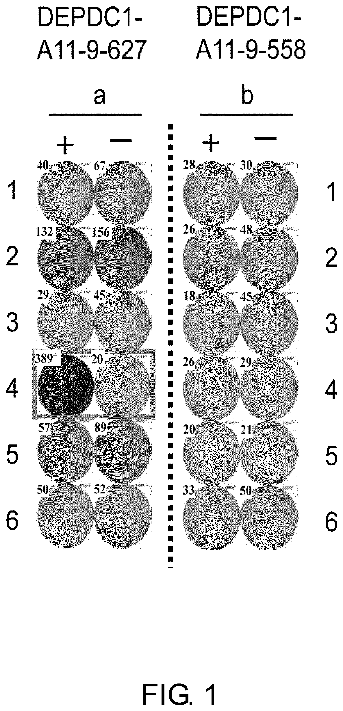 Depdc1-derived peptide and vaccine containing same