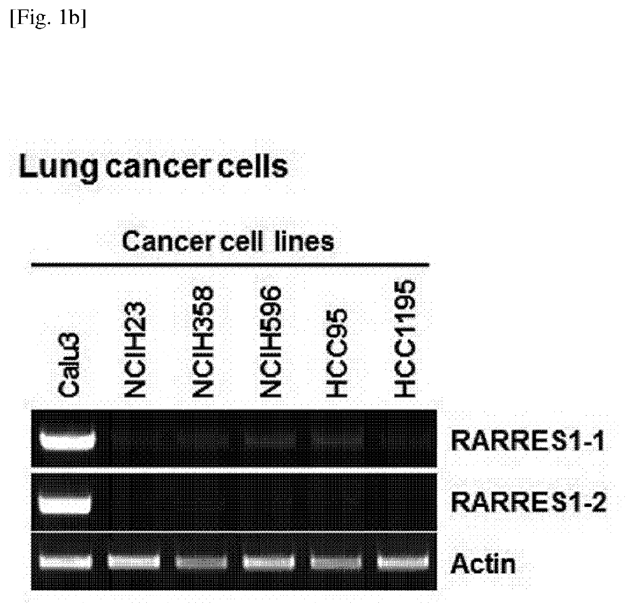 A method for screening a therapeutic agent for cancer using binding inhibitor of cyclin-dependent kinase 1 (CDK1)-cyclin b1 and retinoic acid receptor responder 1 (rarres1) gene knockout animal model