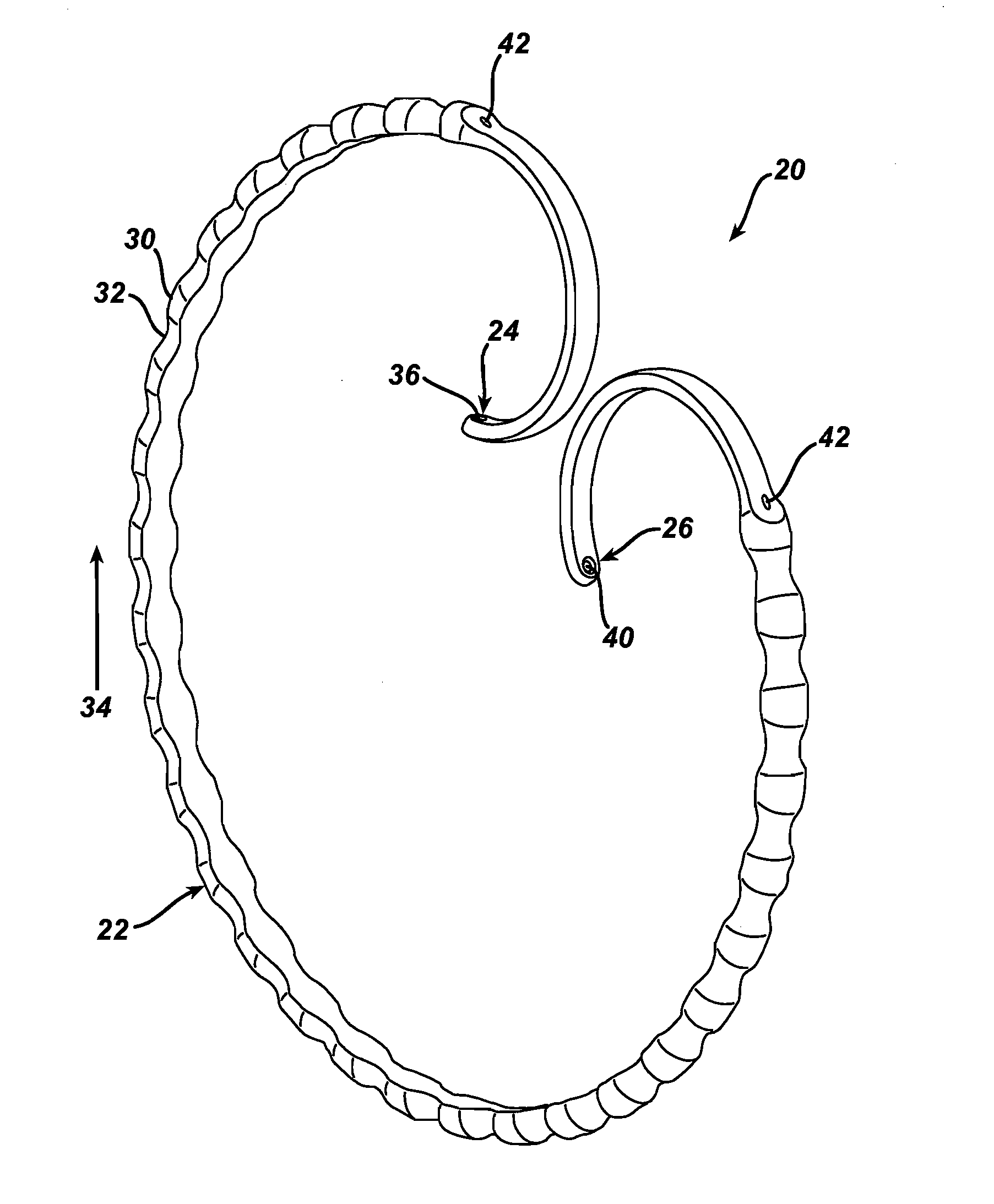 Method of remotely adjusting a satiation and satiety-inducing implanted device