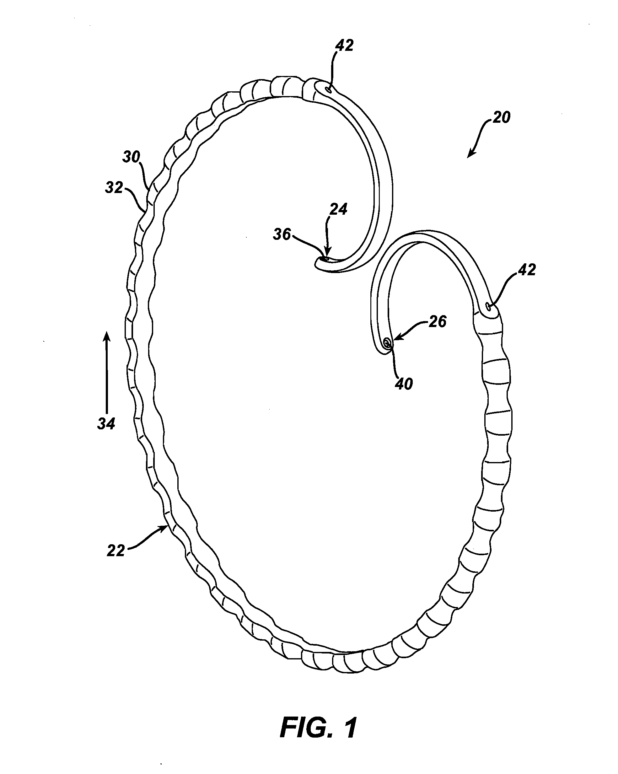 Method of remotely adjusting a satiation and satiety-inducing implanted device