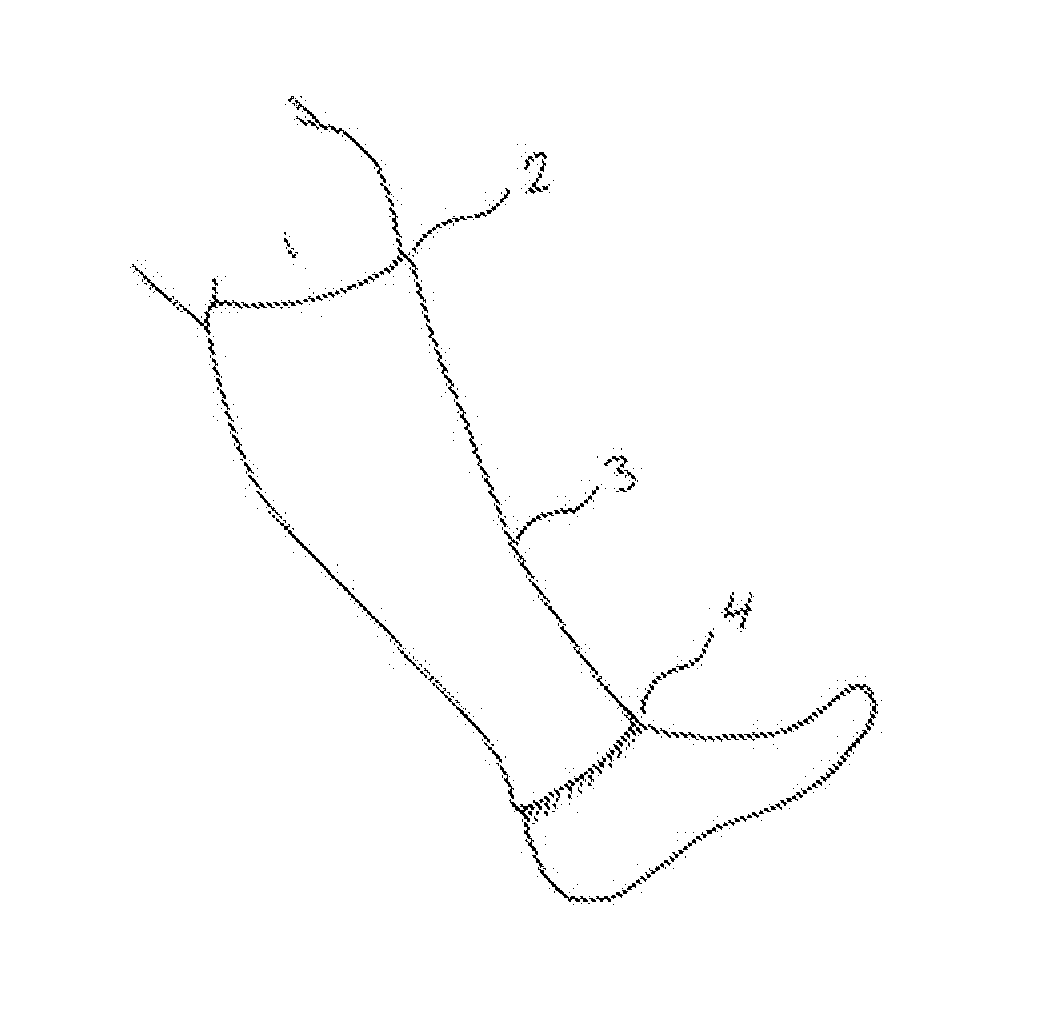 A compression garment for provision of an adjustable pressure