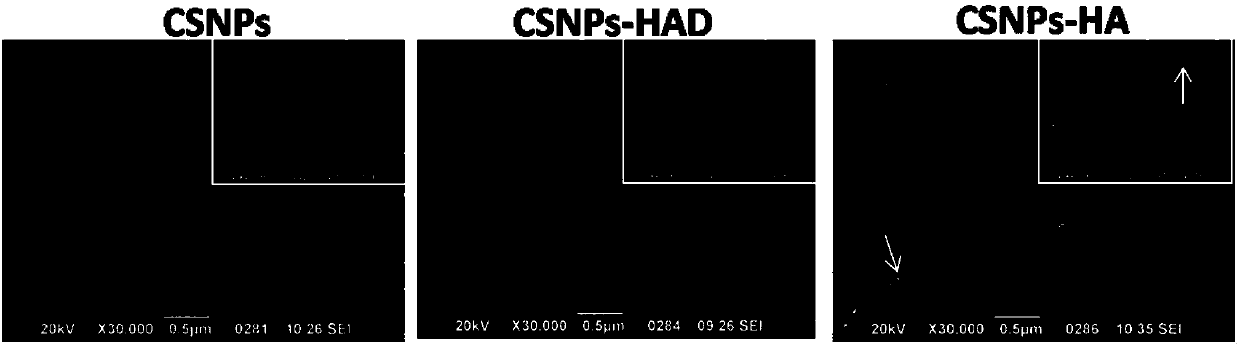 Gene targeting delivery system aiming at CD44 high expression type tumors and application