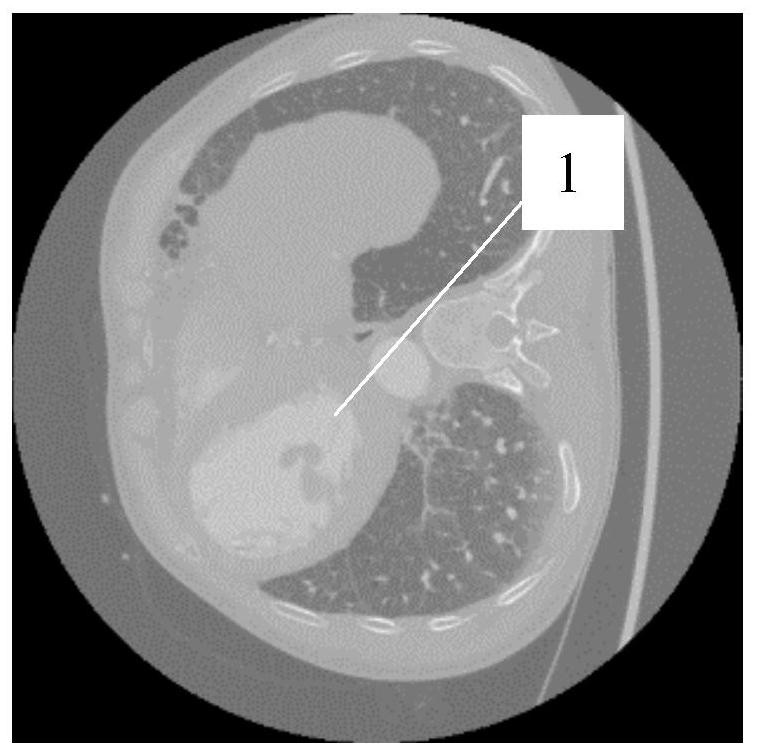 Aorta structure image automatic segmentation method based on artificial intelligence