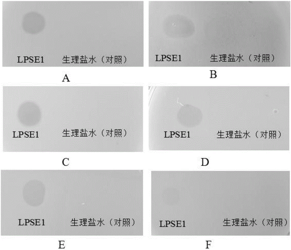 Salmonella bacteriophage and bacteriophage anti-bacterium composition and application thereof