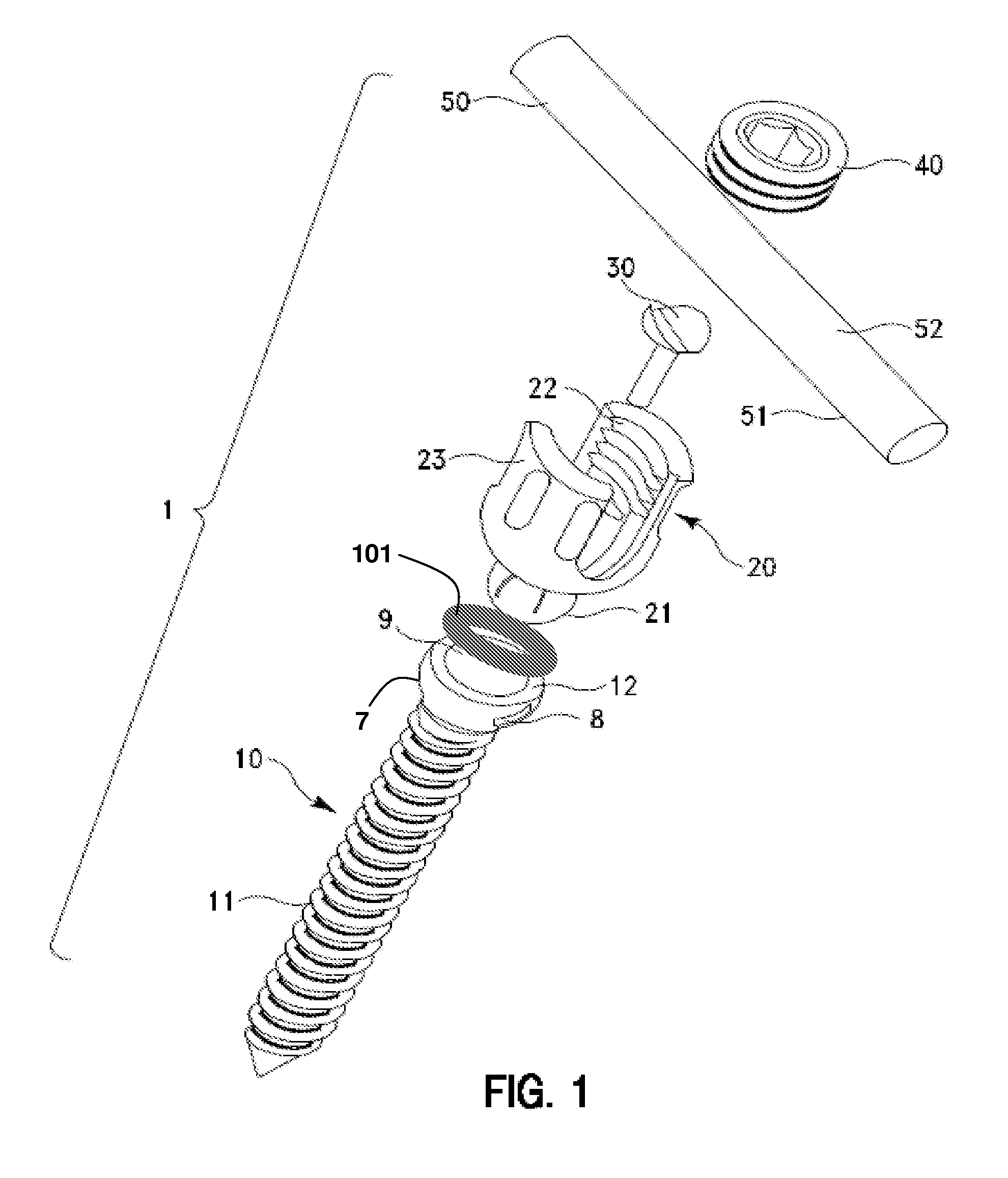 Spring-loaded, load sharing polyaxial pedicle screw assembly and method