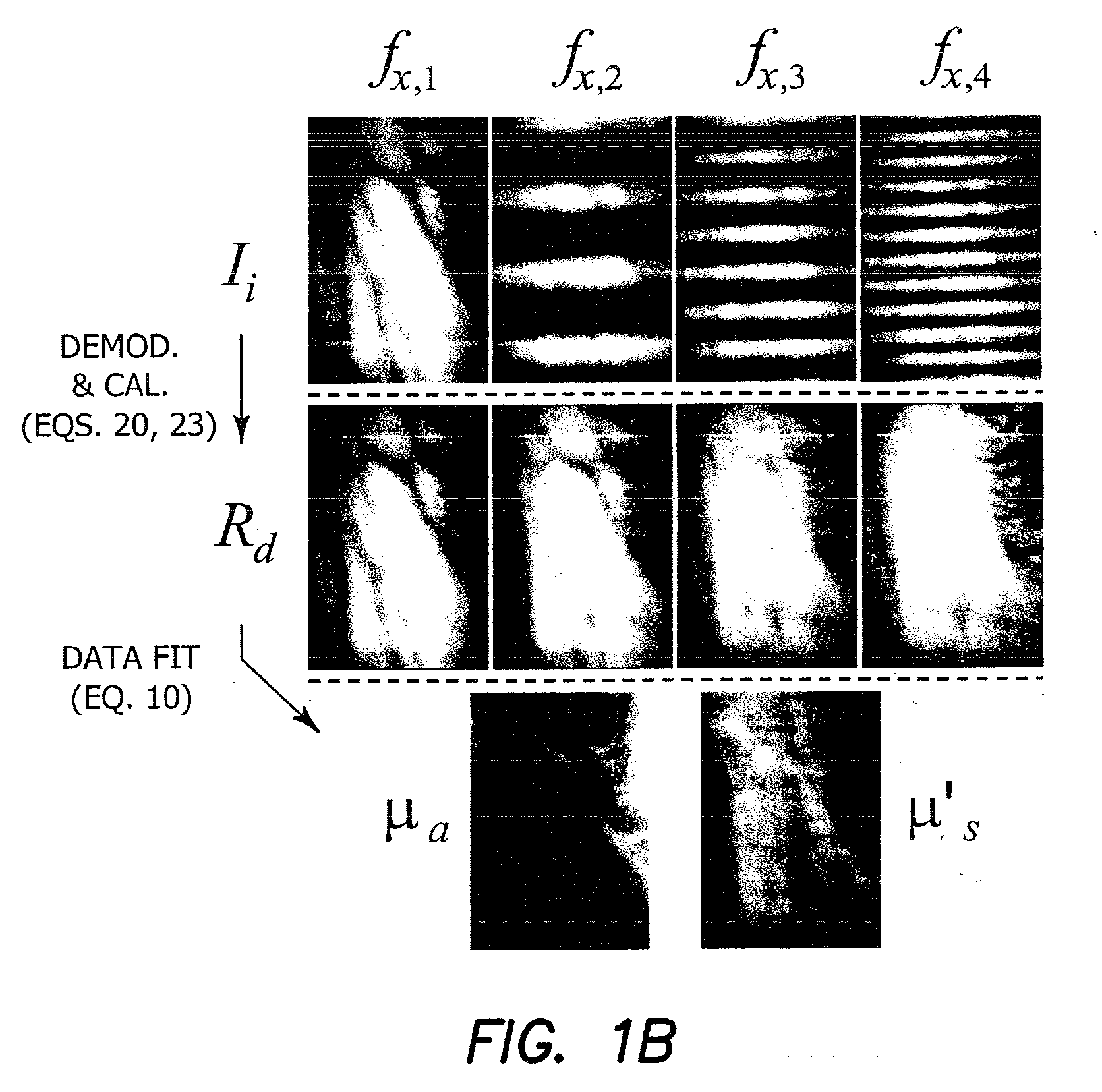 APPARATUS AND METHOD FOR WIDEFIELD FUNCTIONAL IMAGING (WiFI) USING INTEGRATED STRUCTURED ILLUMINATION AND LASER SPECKLE IMAGING