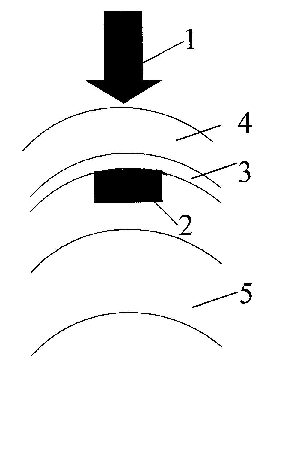 Method and apparatus for treatment of presbyopia by lens relaxation and anterior shift