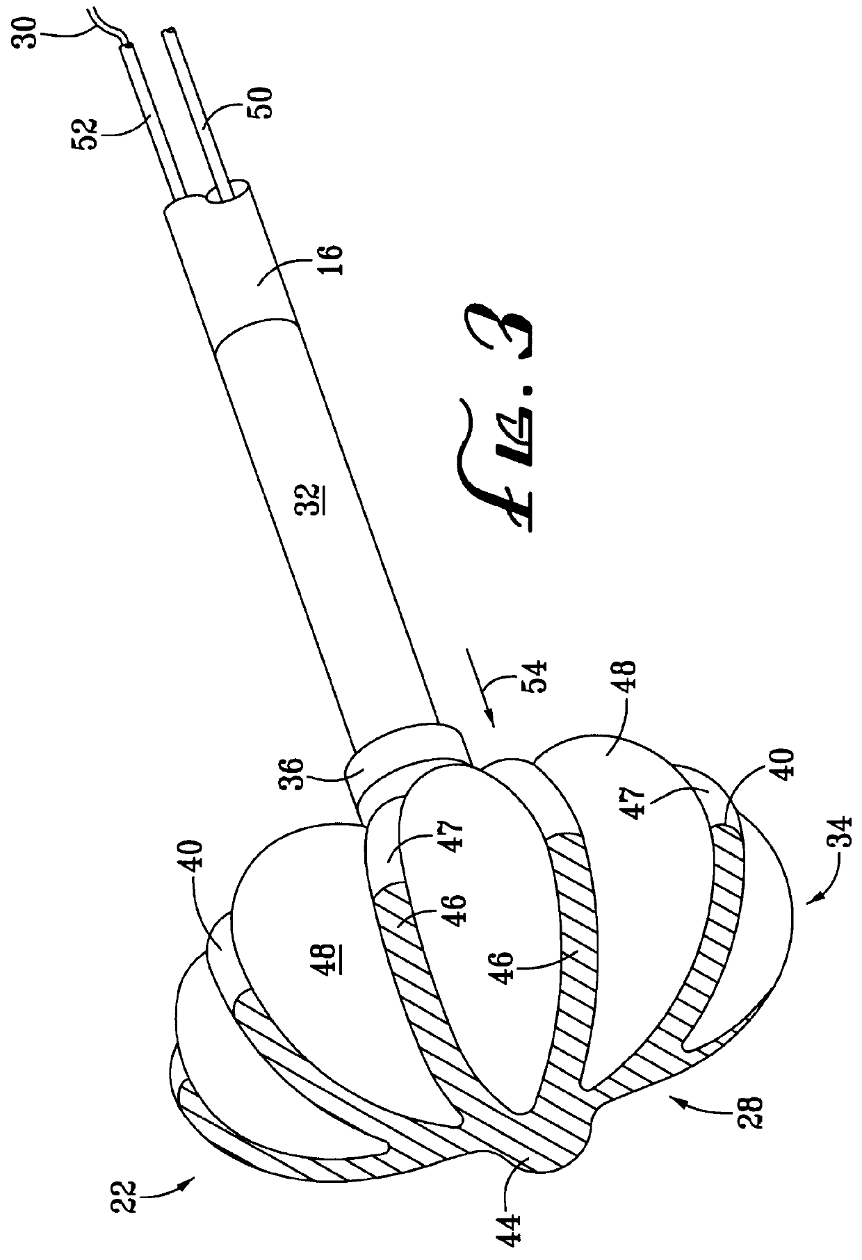 Collapsible spline structure using a balloon as an expanding actuator