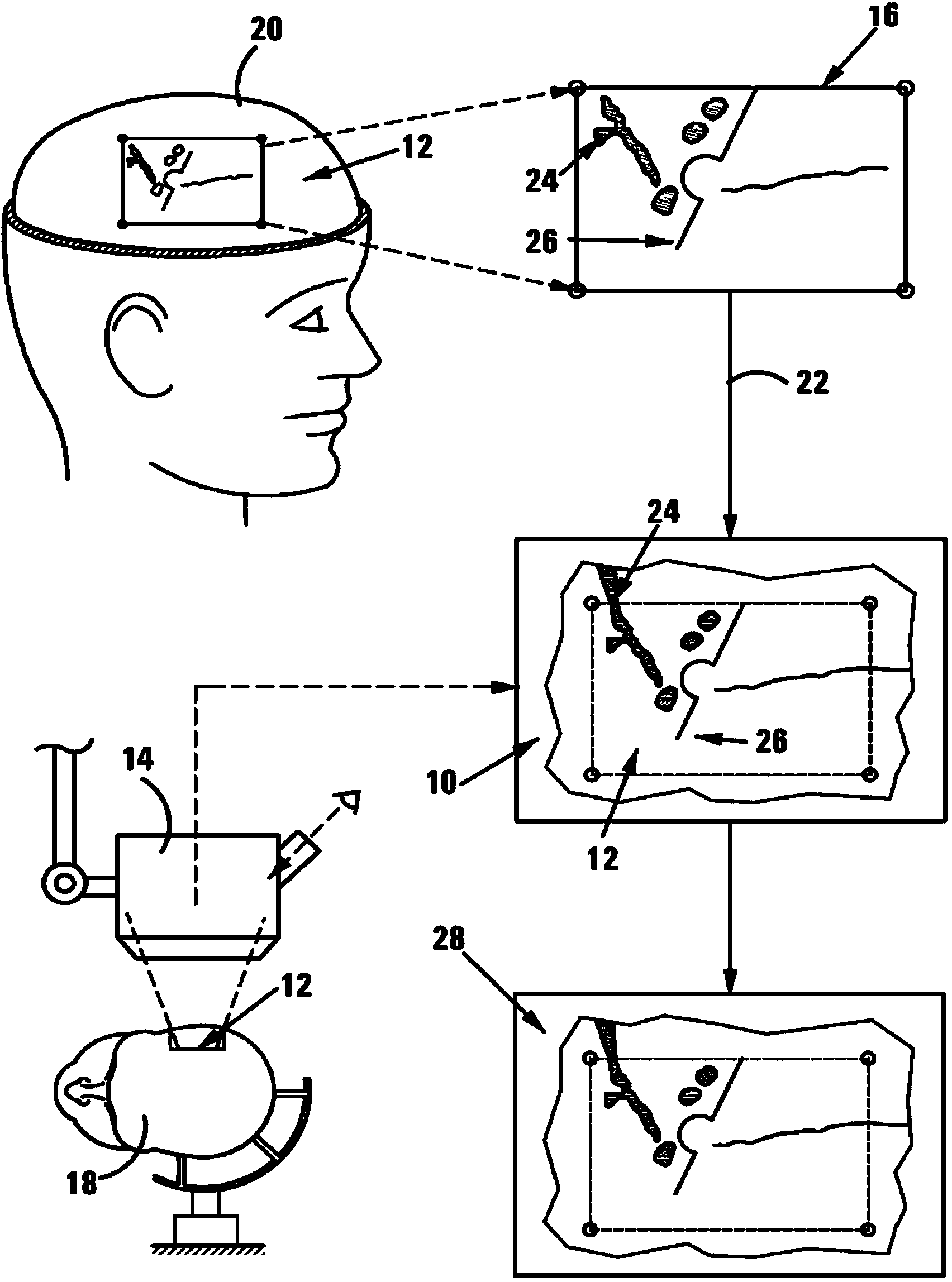 Method of and system for overlaying NBS functional data on a live image of a brain