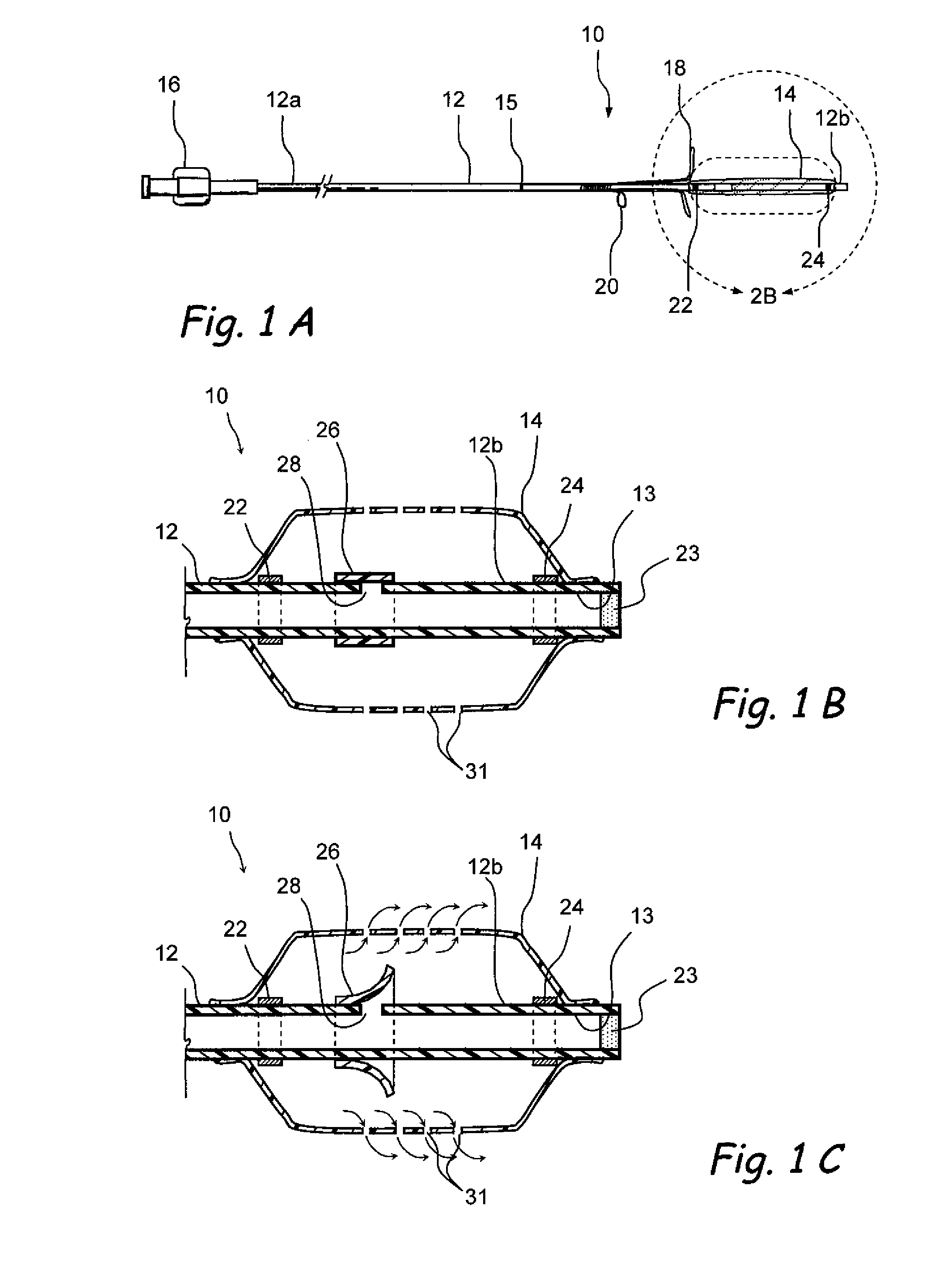Implantable Devices and Methods for Treating Sinusitis and Other Disorders