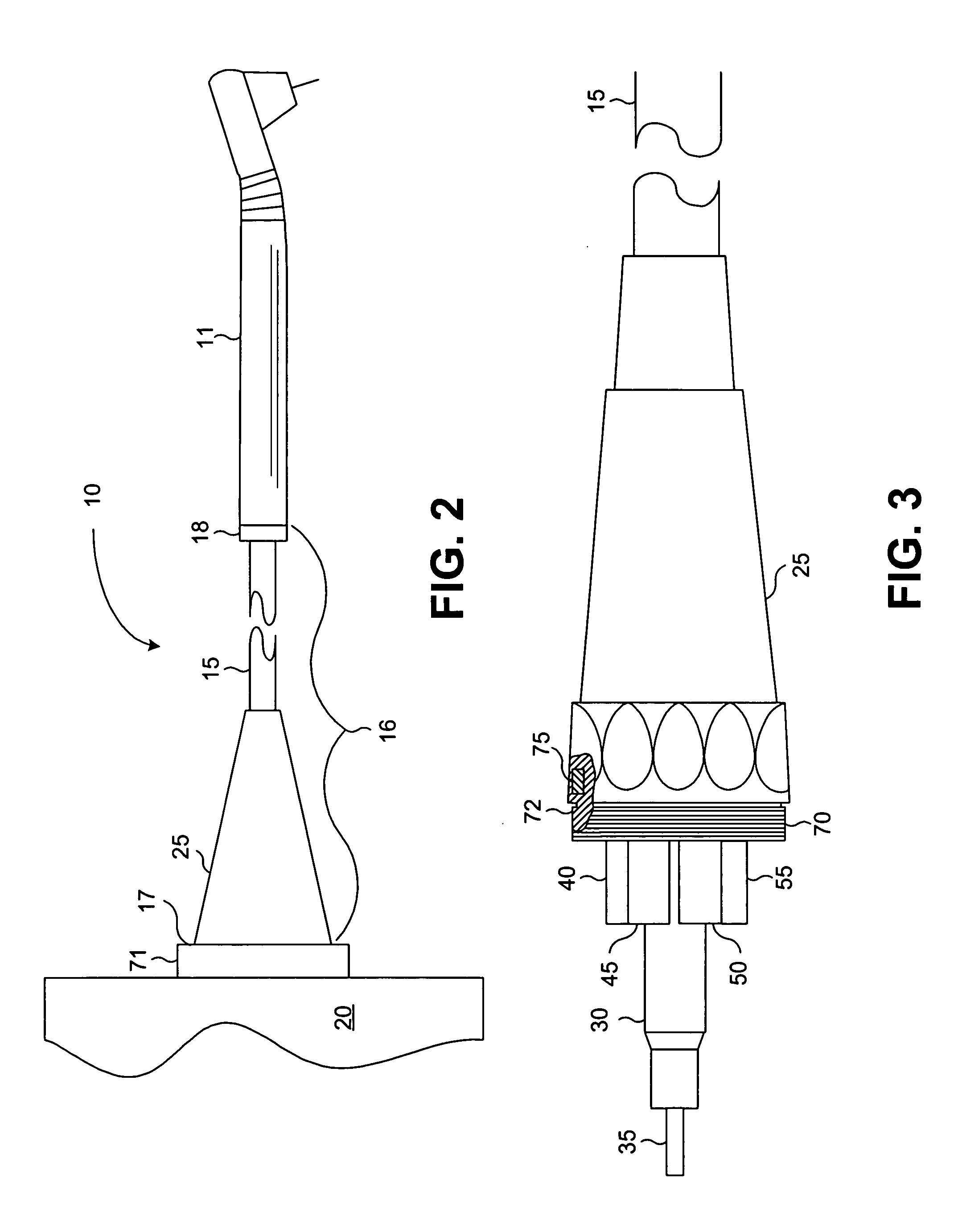 Identification connector for a medical laser handpiece