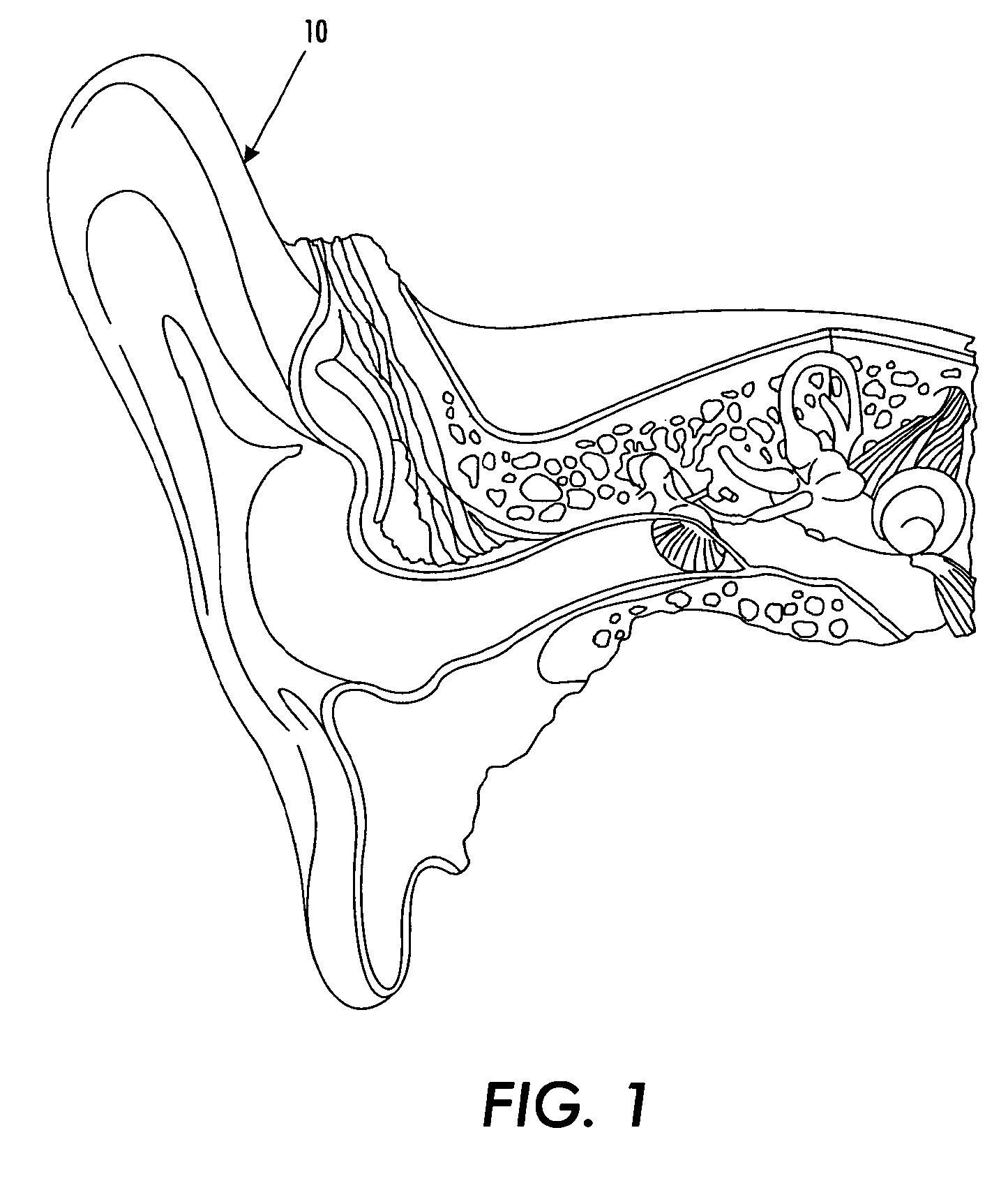 In the ear hearing aid utilizing annular acoustic seals