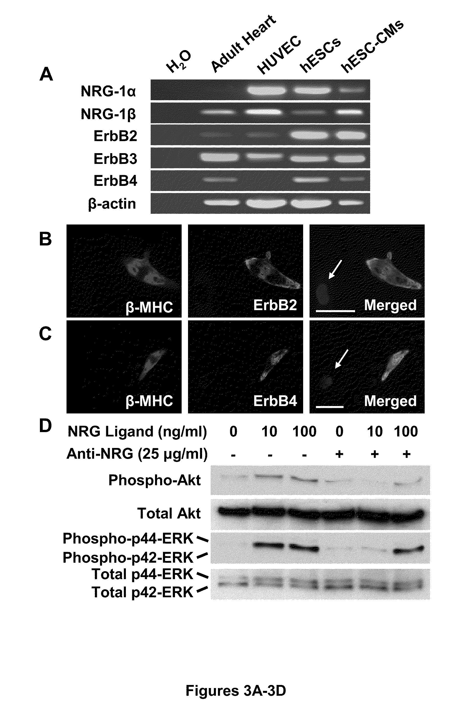 Induction of human embryonic stem cell derived cardiac pacemaker or chamber-type cardiomyocytes by manipulation of neuregulin signaling