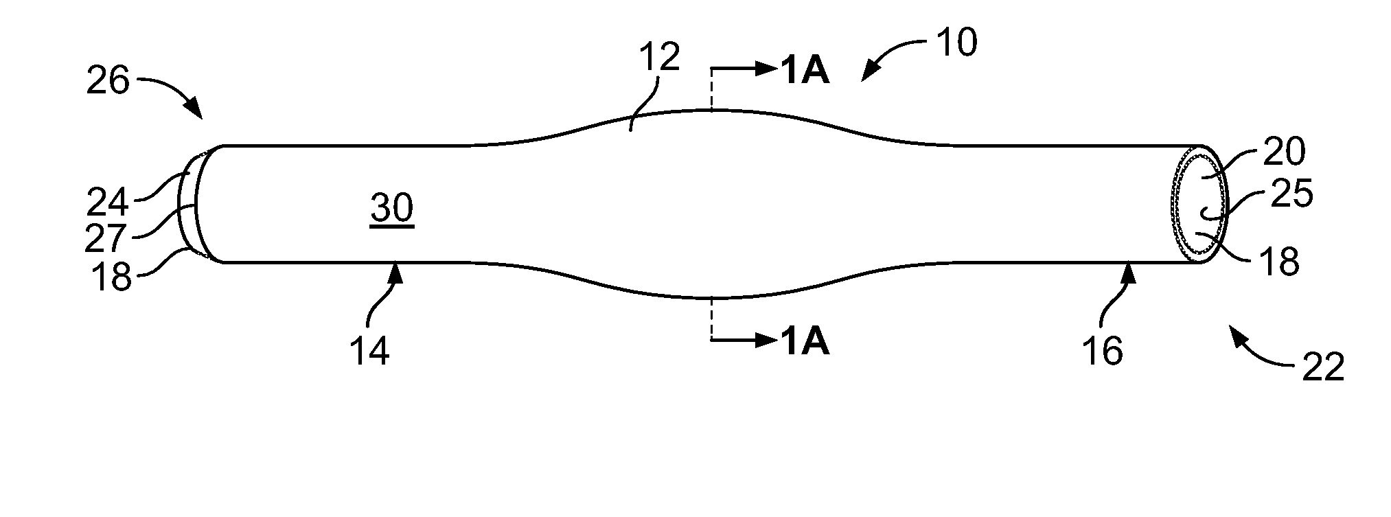 Stent device for anastomoses of blood vessels and other tubular organs