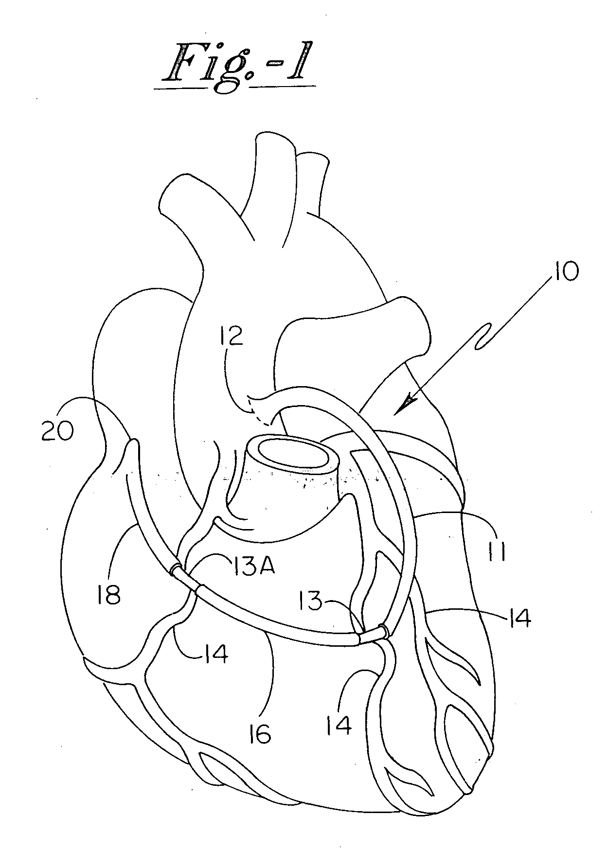 Grafted network incorporating a multiple channel fluid flow connector