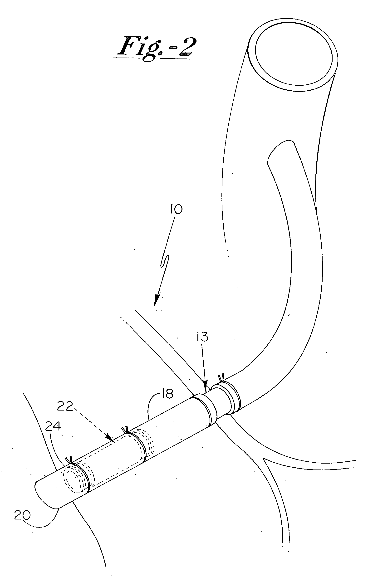 Grafted network incorporating a multiple channel fluid flow connector