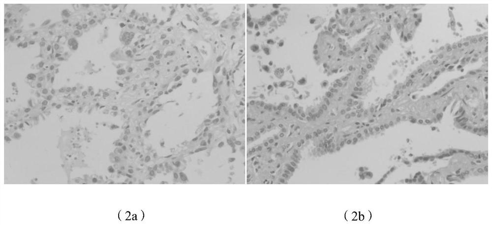 A kind of pathological tissue transparent dewaxing liquid and preparation method thereof